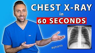 How to read a Chest X-ray in 1 Minute #shorts - Marijuana Learn